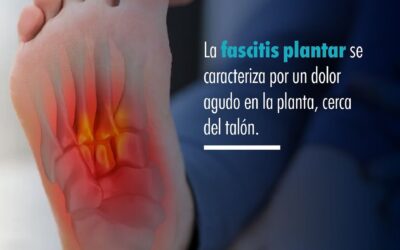 ¿Qué es la fascitis plantar?