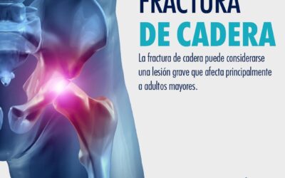 Fractura de cadera